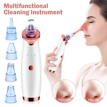 Premium Vacuum Blackhead Remover